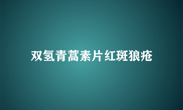 双氢青蒿素片红斑狼疮