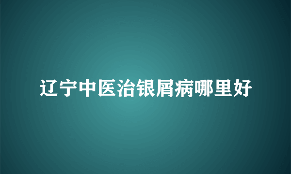 辽宁中医治银屑病哪里好