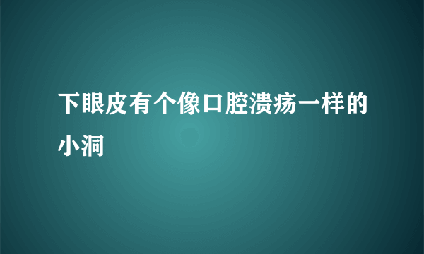 下眼皮有个像口腔溃疡一样的小洞