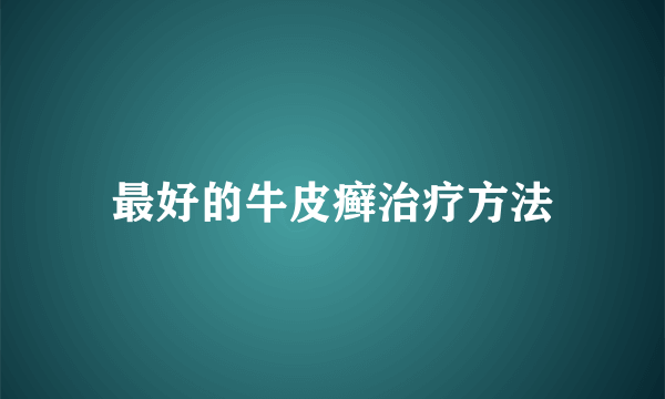 最好的牛皮癣治疗方法
