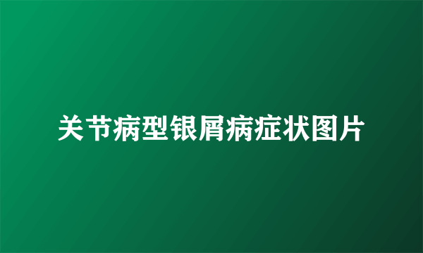 关节病型银屑病症状图片