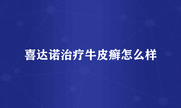 喜达诺治疗牛皮癣怎么样