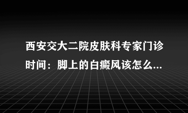 西安交大二院皮肤科专家门诊时间：脚上的白癜风该怎么治疗好?