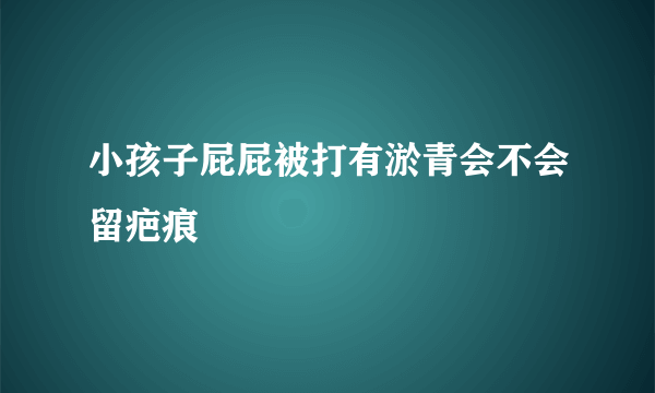 小孩子屁屁被打有淤青会不会留疤痕
