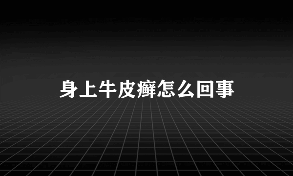 身上牛皮癣怎么回事