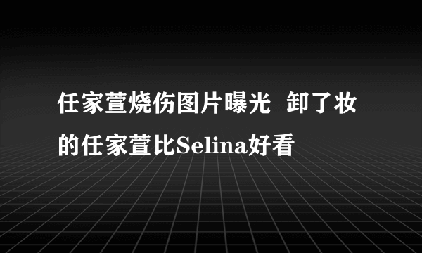 任家萱烧伤图片曝光  卸了妆的任家萱比Selina好看