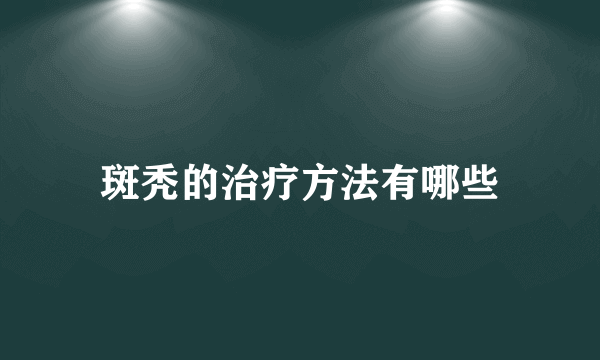 斑秃的治疗方法有哪些