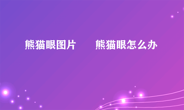 熊猫眼图片      熊猫眼怎么办