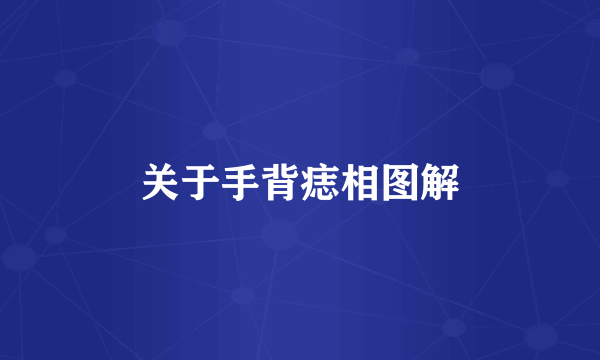 关于手背痣相图解